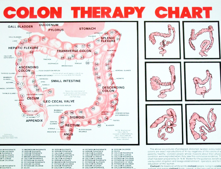 colon therapy chart